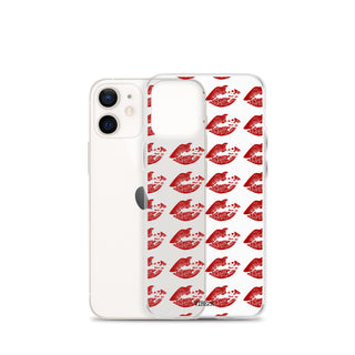 Kiss of Death iPhone Case