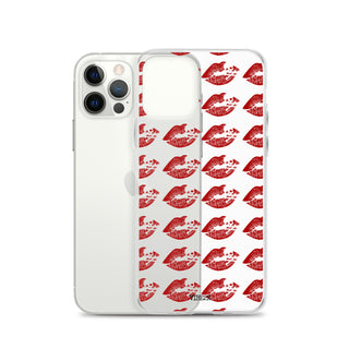 Kiss of Death iPhone Case